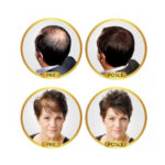 revolumen-hair-vlakna-za-proredjenu-kosu-6