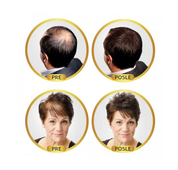revolumen-hair-vlakna-za-proredjenu-kosu-6