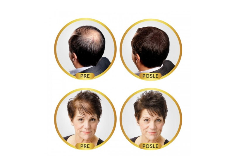 Revolumen Hair – vlakna za proređenu kosu